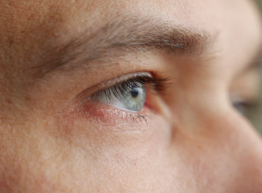 Close-up of irritated eye